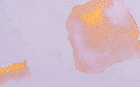 �����鹤���ܽ�